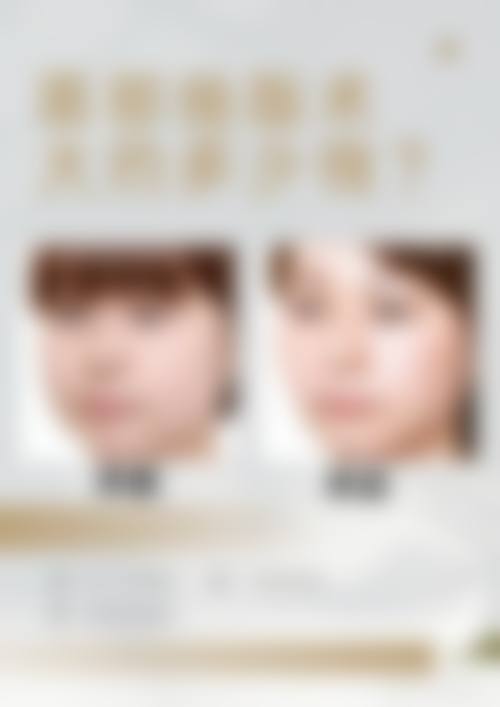 2. 鼻部整形价格及特点