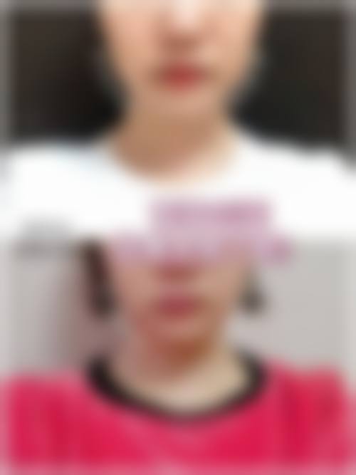 瘦脸针医院与医生选择中，哪些因素更关键？及医院医生推荐！