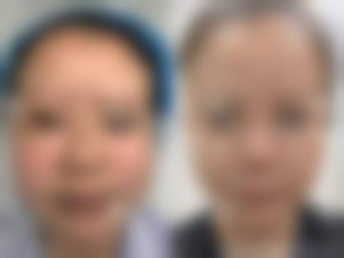 1 - 3个月成效至佳的真相揭秘