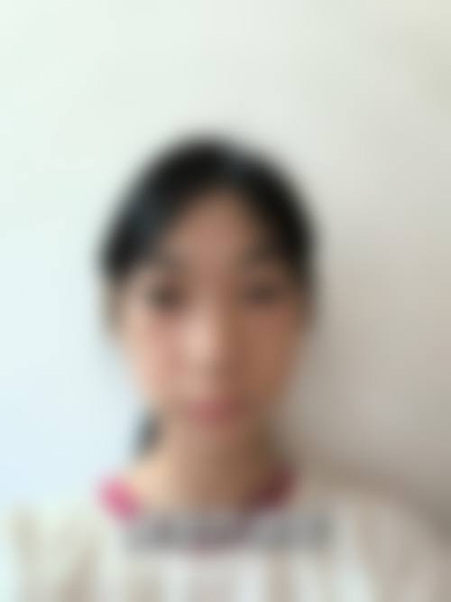 瘦脸针哪些人群适合，哪些情况不建议选择？