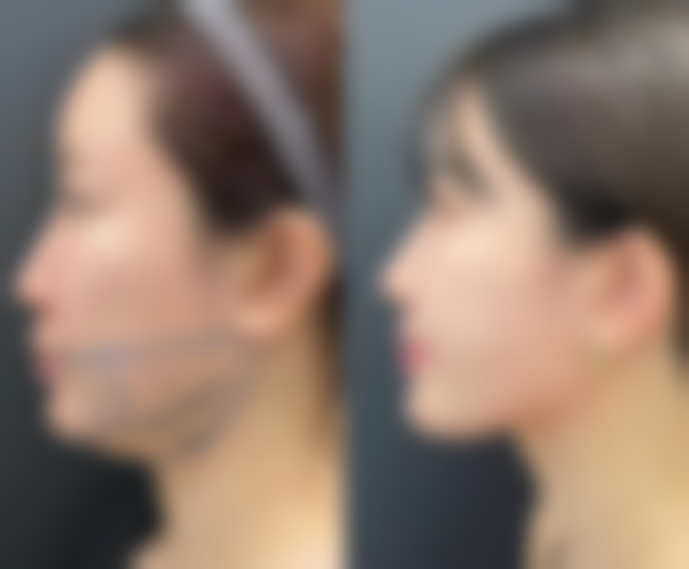 张晓东医生坐诊哪个医院?