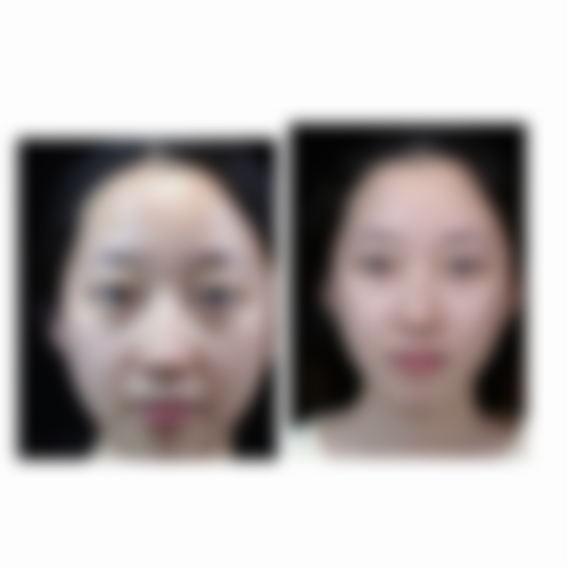 五、延伸解惑:甘肃省人民医院正畸和皮肤美容科怎么样?