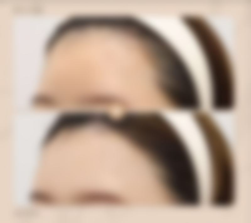 西安唇部整形医院排名前十名：哪家技术强？这几位医生口碑超靠谱