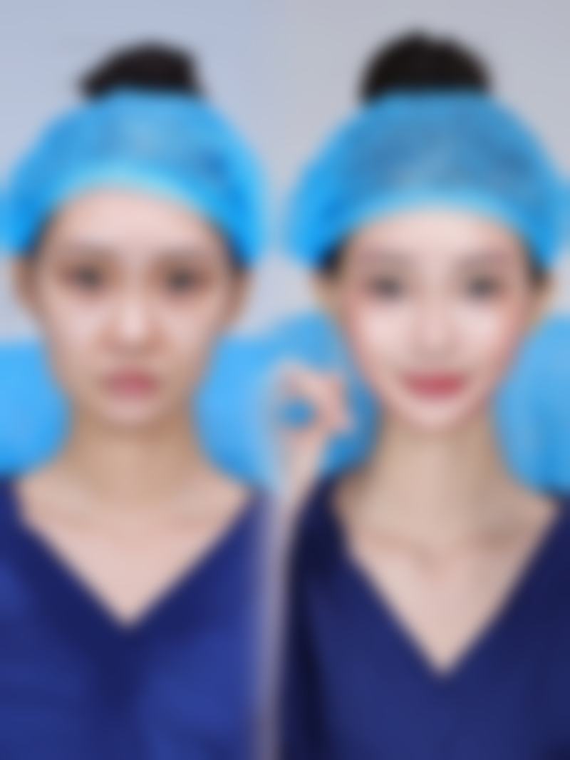 七、哪些人适合选择成都军大整形?避坑指南请收好!