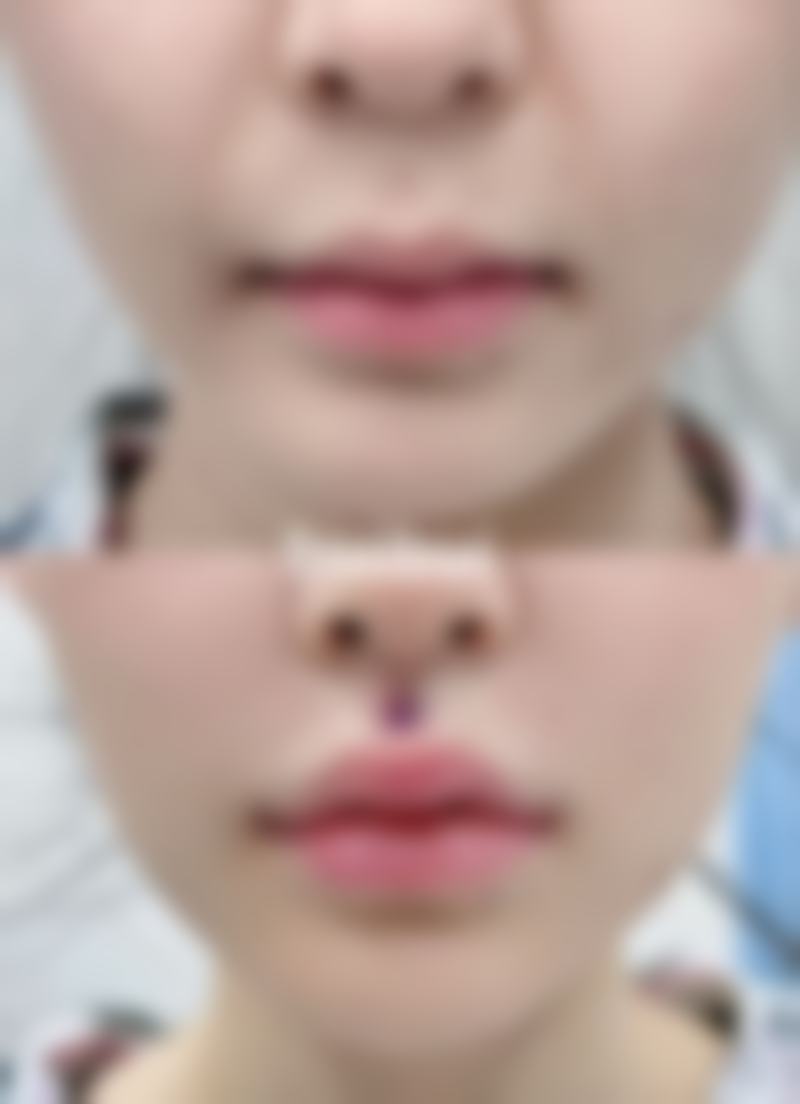 西安唇部整形排名第8名——陕西西安晶肤美容医院