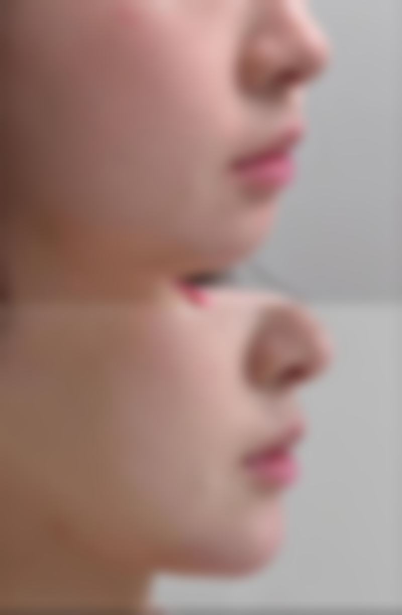 张晓东医生预约挂号