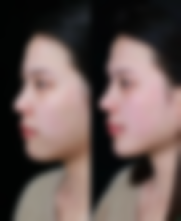 上海吸脂手术预约挂号流程：具体步骤是啥？怎样操作最便捷？官网或电话预约，一步到位！ 