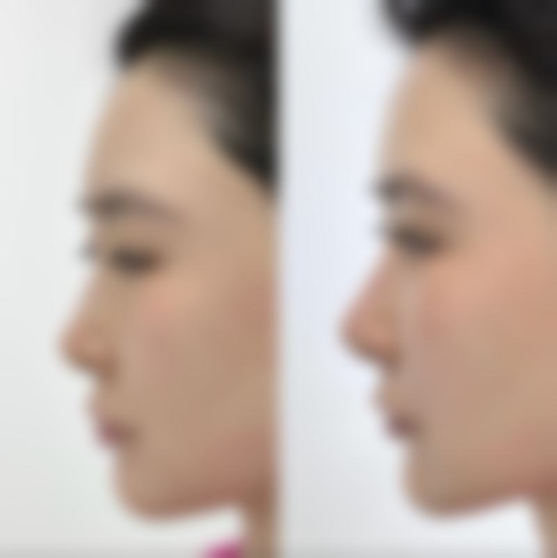 西安唇部整形排名第10名——秦都口腔医院整形美容