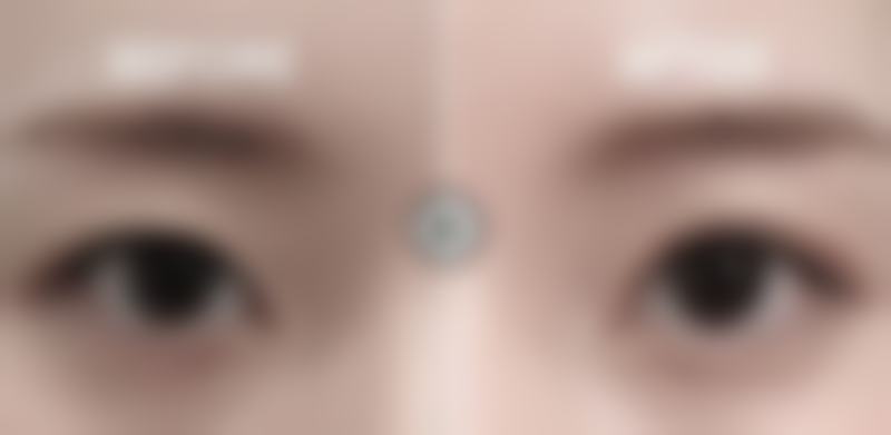 男生眼袋重会带来哪些影响？