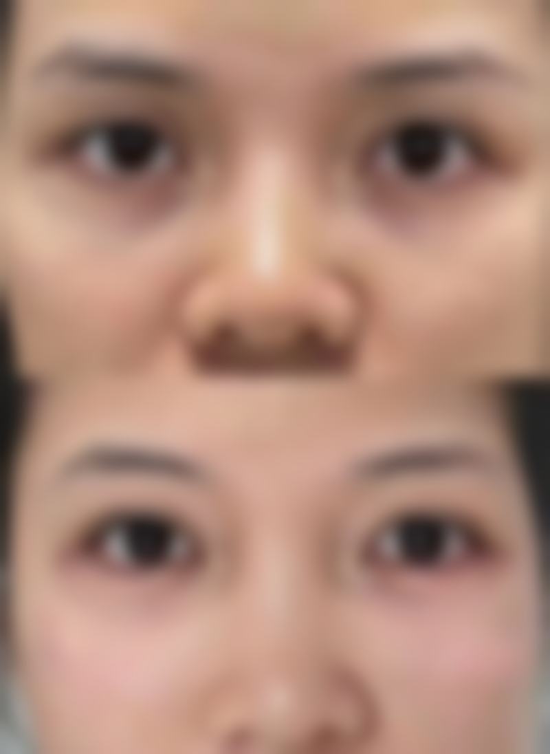 金刀奖院长刘志刚：眼部修复的“定海神针”