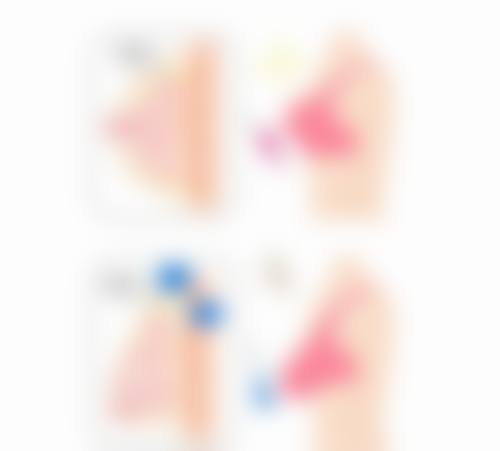 1、主要做的三大诊疗项目