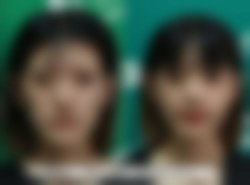 四川成都美容整形医院价格表:邓娟娟擅长项目收费如何?