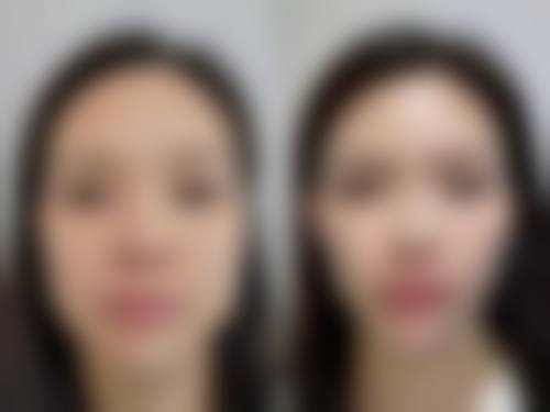 杭州天鑫医美怎么预约挂号？3种方式操作简单不排队