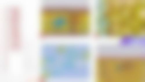 西安无痕筋膜提升多少钱？收费标准咋样，能用医保不？2026年价格参考：1.5万元起，详解面部smas无痕筋膜提升术