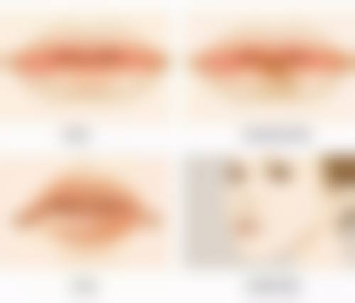 不同项目使用北京艾莉薇传奇的价格