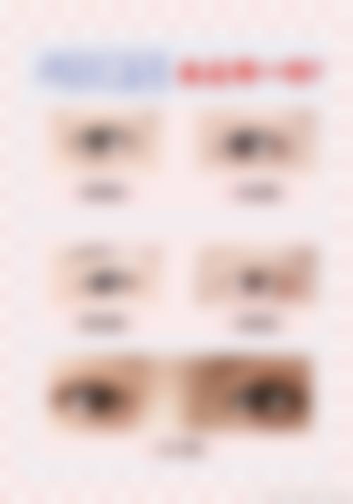 上海同济大学附属天佑医院(医疗美容科)24小时人工服务：全天候在线咨询，拉皮手术找王小民医生怎么样？