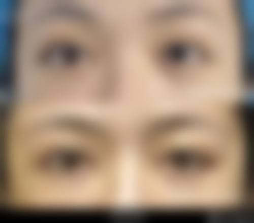 六、北京三仁医疗美容门诊部口碑实例：真人成效到底有多“香”？