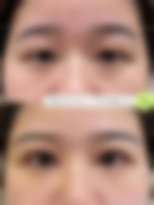 避坑小贴士：选对医院医生，变得更美不踩雷