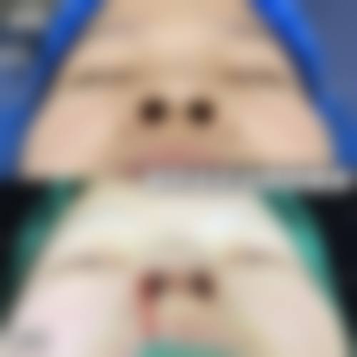 杭州天鑫医美医院地址电话&预约挂号:轻松开启变得更美之旅