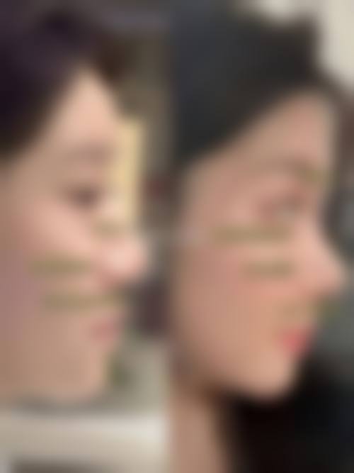 沈阳北方整形医院价格表:透明合理,无隐形消费