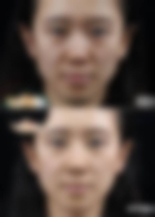 四、热门项目全解析：成效、价格一目了然