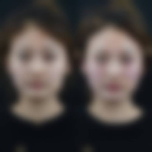 四、除了拉皮,天佑医院美容科还有哪些“宝藏项目”?