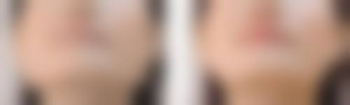 六、杭州天鑫医疗美容医院收费明细一览:透明定价+多重优惠,拒绝隐形消费