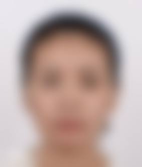 优雅人整形外科价格表：热门项目收费公开，性价比如何？