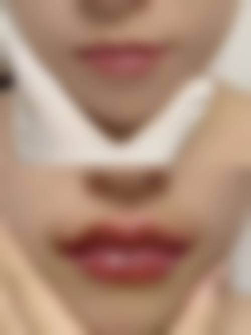 广州唇部整形项目收费情况