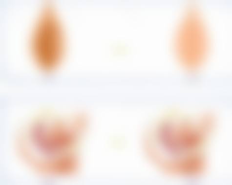 深圳人民医院整形科预约挂号官网：孙辉、于丽等医生坐诊，眼鼻胸综合整形超专业