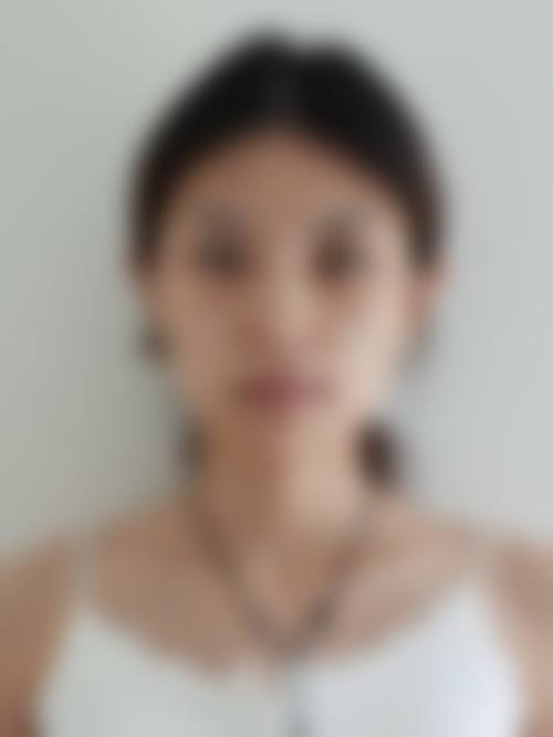 三、去深圳富华医疗美容医院前,如何利用官网做好功课?