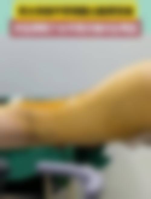 西安吸脂手术：不同医院等级的价格差异及适配人群