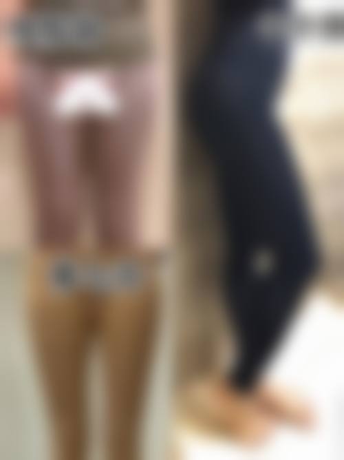 西安吸脂手术价格差异的核心因素及避坑指南