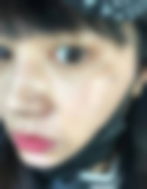 二、白雪医生擅长项目介绍