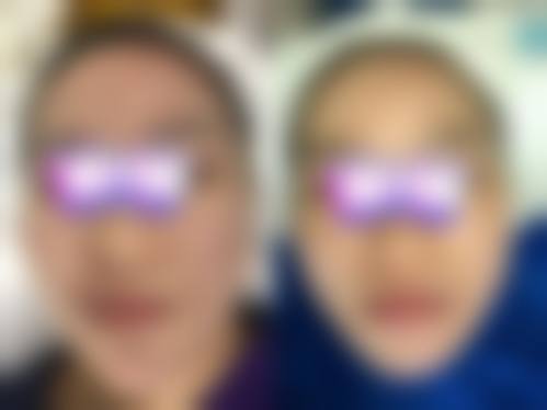 成都三等甲医院治痘痘怎么样