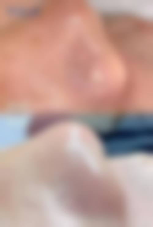 成都三等甲医院祛痘