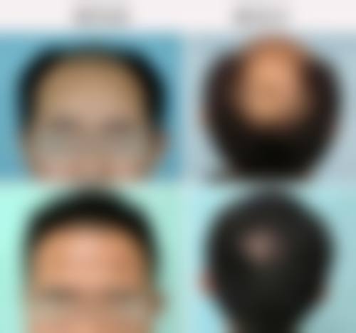 二、文辉才医生擅长项目