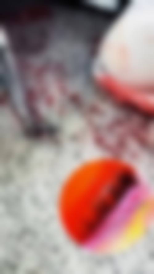 北京头发种植术植发一般价格：微针8元/单位起，大麦植发半年浓密效果超自然！