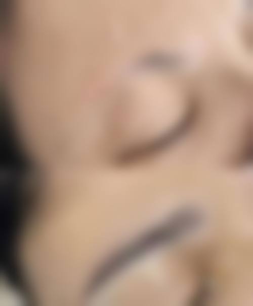 北京头发种植医院怎么选？结合价格与成效的高性价比推荐