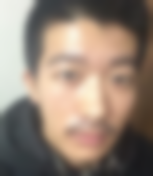 北京头发种植术植发价格差异的核心影响因素