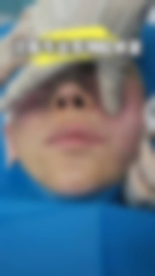 No.2 北京积水潭医院——骨科优势助力奥美定取出