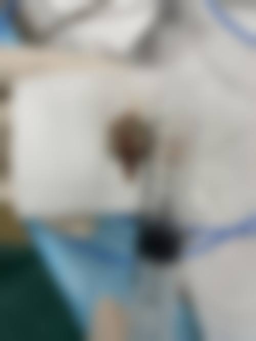 {杭州天鑫医疗美容医院属于什么档次？杭州前十正规靠谱医美，双眼皮3000+轮廓固定4k+