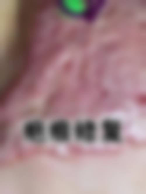 五、楚雄吴氏嘉美美容门诊部收费价格表/收费标准