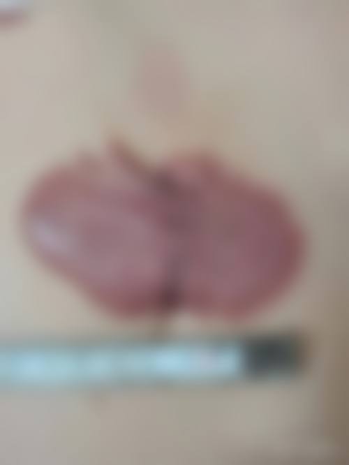 太原华晋医院整形科（原山西省太原整形外科）设备仪器