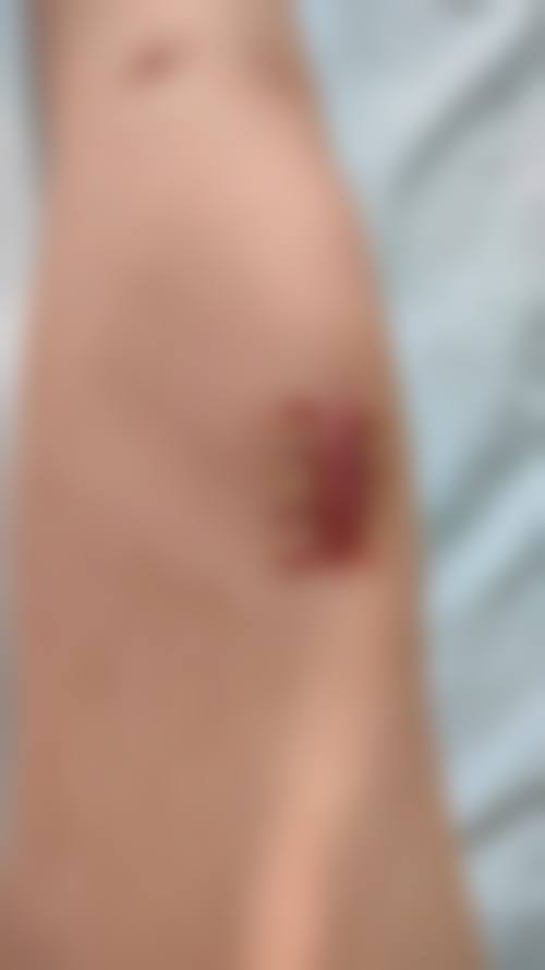 七、楚雄吴氏嘉美美容门诊部就诊预约挂号指南