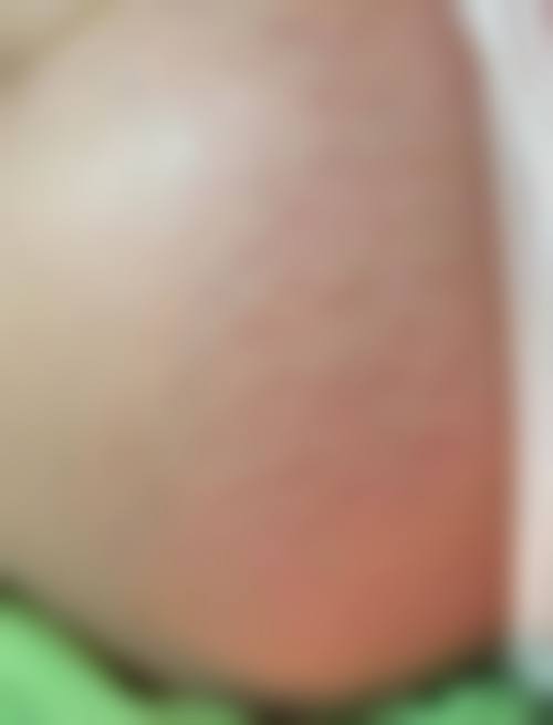 成都高新春天整形医院常见问题解答