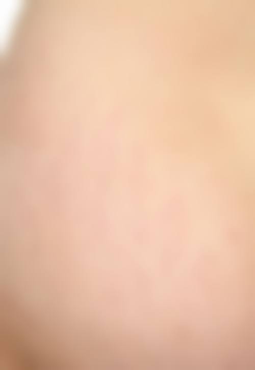 新疆塔城优兰卡医疗美容诊所形体雕塑技术优势