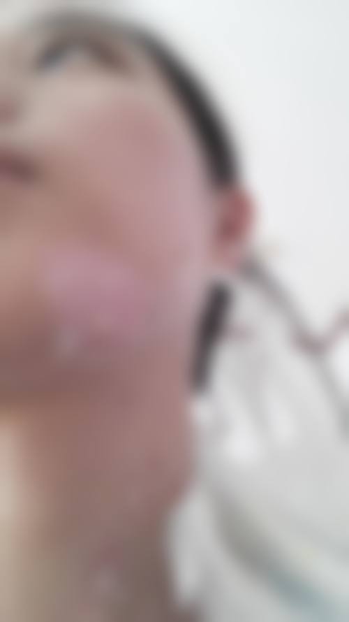 9. 日本MAXFACS GINZA美容整形医院口碑如何