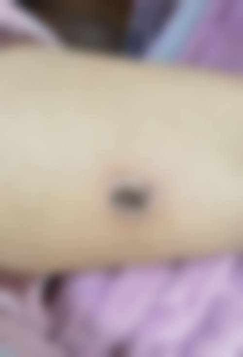 潮州市保丽圣美医疗美容医院患者常见问题解答