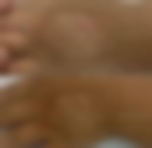 十一、患者常见问题解答（精选）